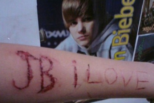 justin bieber cut into arm